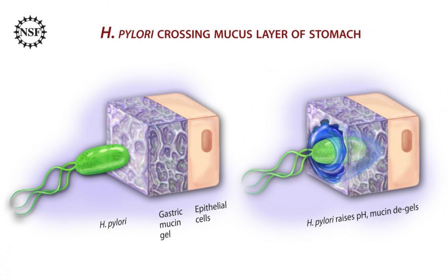 A visual of the bacterium, H. Pylori, and how it infiltrates the body and infects it.