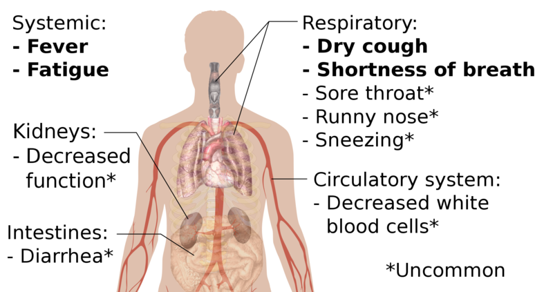 COVID-19+has+become+a+pandemic%2C+causing+EPISD+to+take+action.